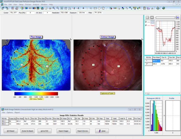 MCAO model showing baseline bloodflow image. 10 micron resolution, intact skull. ROI analysis shows flow reduction