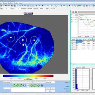 Cortical spreading depression in the rodent brain. Regions of interest monitored over time show progression of the depolarisation across the brain surface