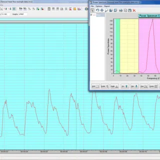 Example femoral head data from moorVMS-PC showing clearly pulsatile flow and FFT analysis confirming strength of the heart rate signal.