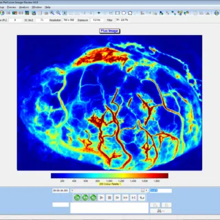 Cerebral blood flow in the exposed human brain