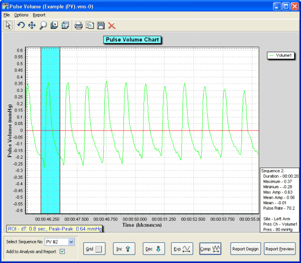 moorVMS-PC PVR analysis screen shot