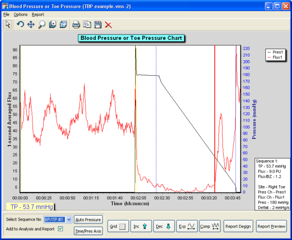moorVMS-PC TBP analysis screen shot