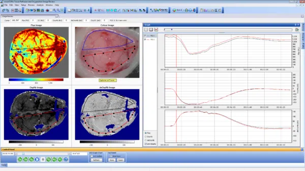 Cerebral Hypoxia protocol – illustrating changes in blood flow, oxy/ deoxy Hb and colour photo of imaging site