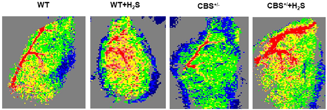Singa et al, Figure 6: The flow was decreased in the CBS+/− mice as compared to the WT controls. H2S treatmentnormalized the blood flow in the limb of CBS+/− mice, *p < 0.05; n = 5–12. 